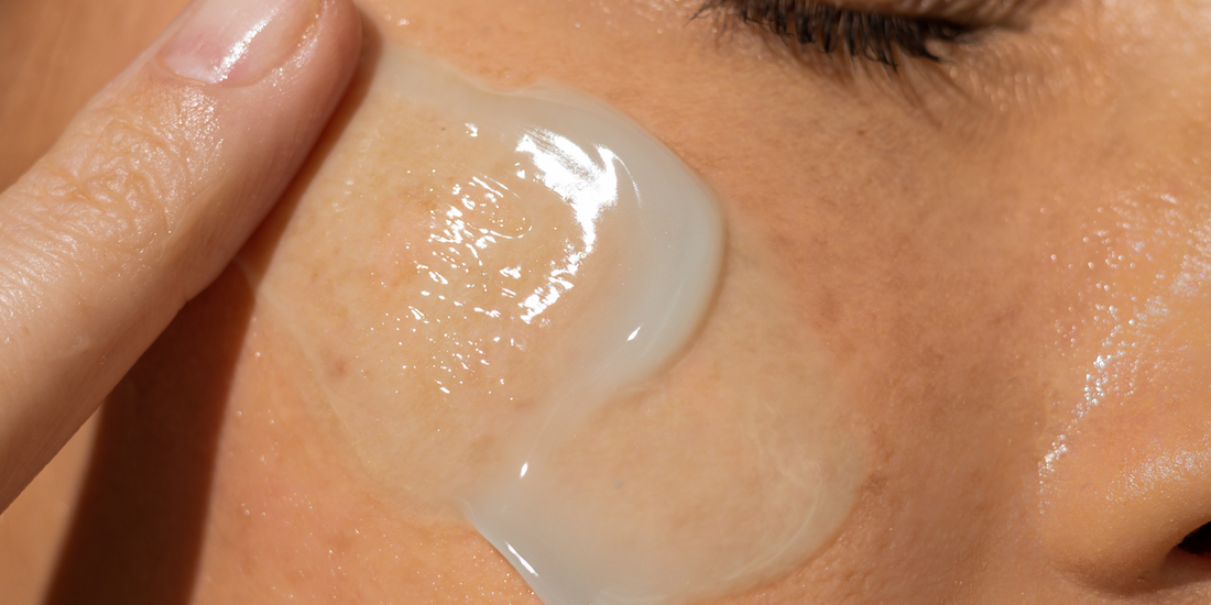 Face-Mapping: What Your Acne Means