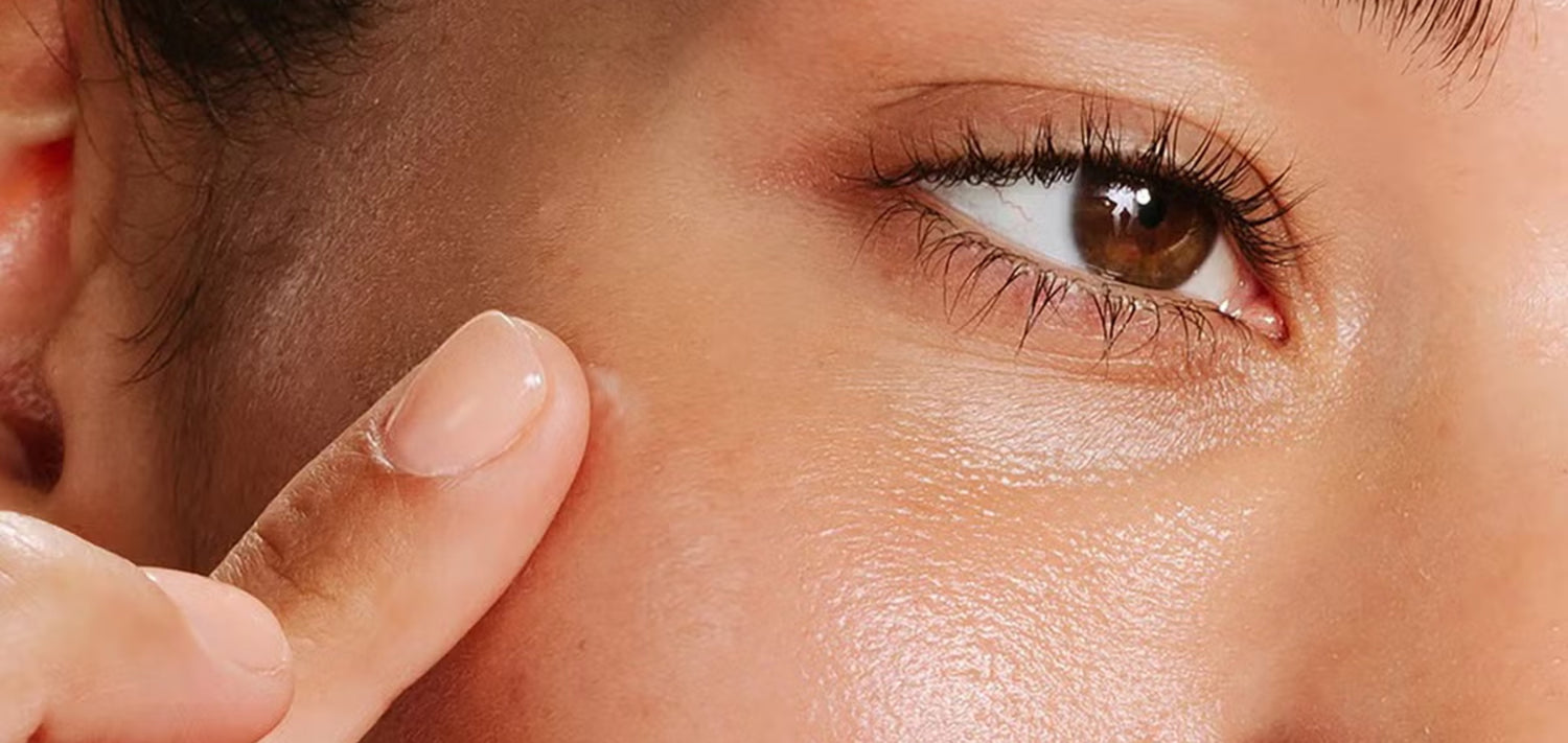 Breakouts & Blemishes